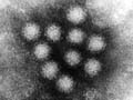 20061213-norovirus.jpg